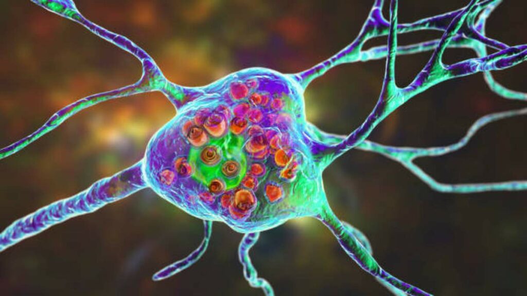 Linking Microorganisms, Nutrition, and Metabolism Consequences for Metabolic Diseases